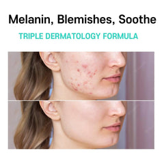 CARE:NEL Anti-Melasma Cica Cream 40ml