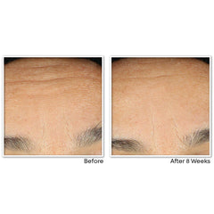 RETINOL CORREXION® Line Smoothing Night Serum Capsules