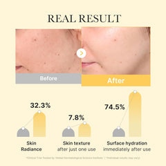 Medicube Kojic Acid Turmeric Gel Mask 1 ea