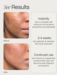 Topicals Like Butter Moisturizer For Dry Eczema-Prone Skin 50 ml 1.75 fl oz