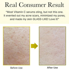 Arencia Vitamin C Booster Shot 30ml