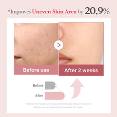 Medicube PDRN Pink Collagen Exosome Shot Serum 7500 30ml