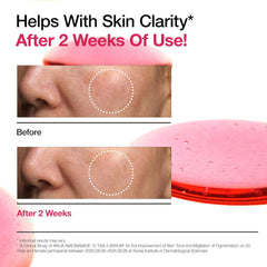 Anua Niacinamide 10 TXA 4 Serum 30ml