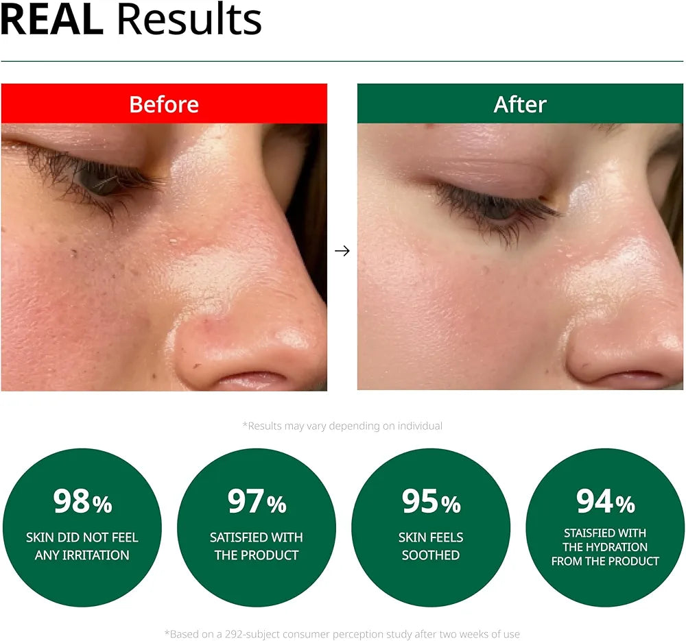 Dr.G NEW RED Blemish Clear Soothing Cream 70ml