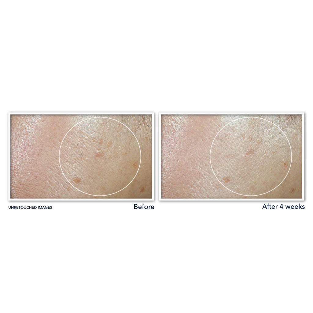 ROC MULTI CORREXION EVEN TONE + LIFT DAILY MOISTURIZER SPF 30