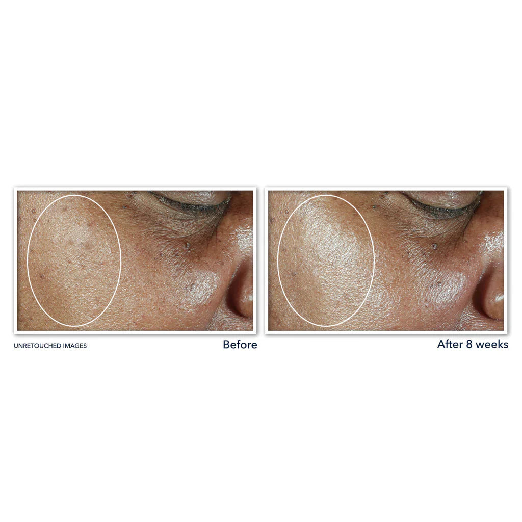ROC MULTI CORREXION EVEN TONE + LIFT DAILY MOISTURIZER SPF 30