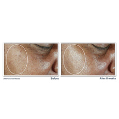 ROC MULTI CORREXION EVEN TONE + LIFT DAILY MOISTURIZER SPF 30