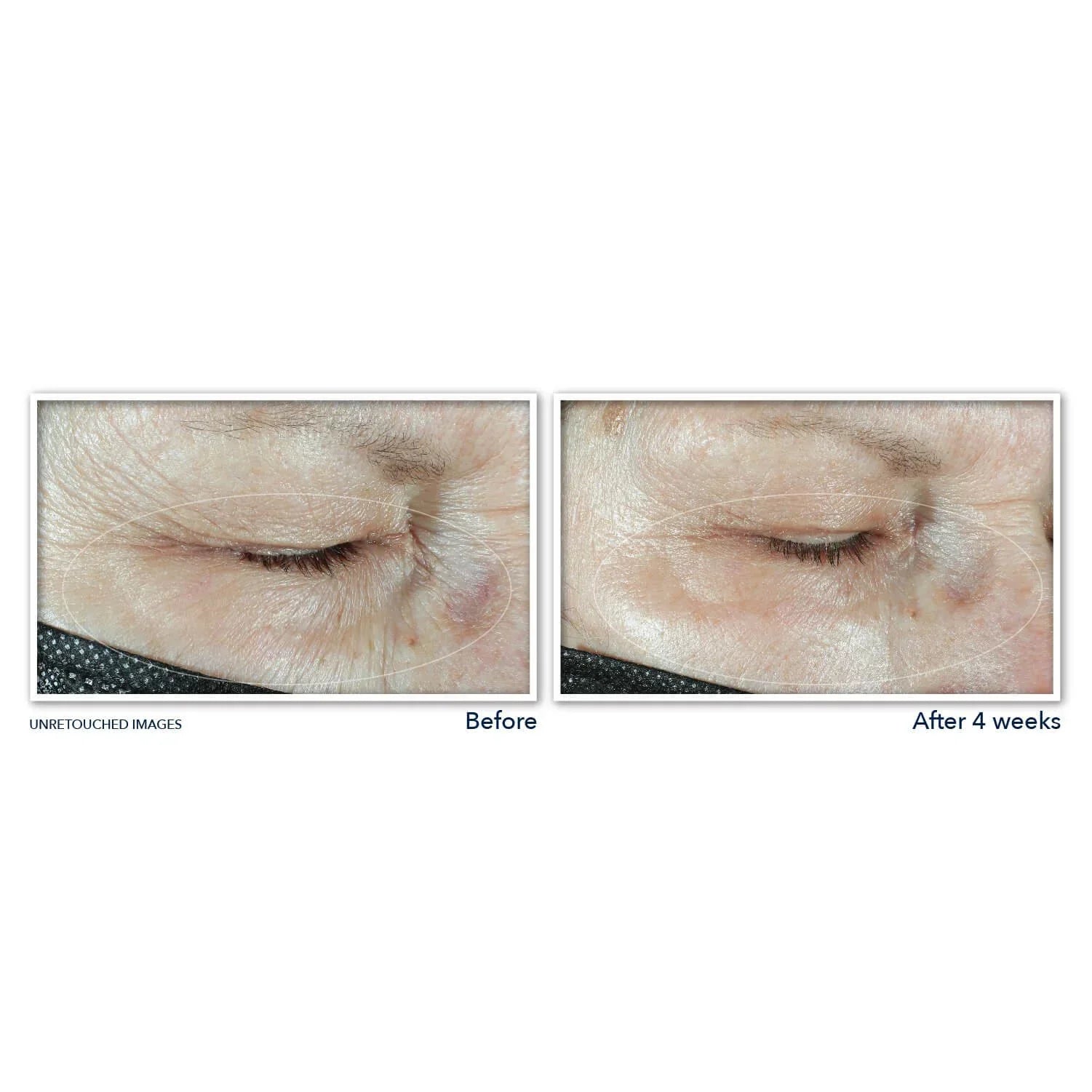 MULTI CORREXION® Hydrate & Plump Eye Cream