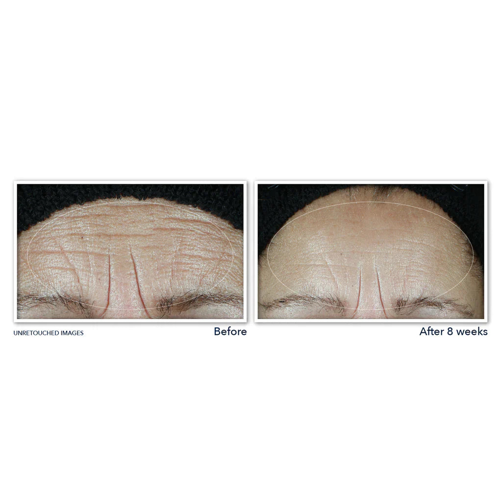 MULTI CORREXION® Hydrate + Plump Moisturizer With SPF 30