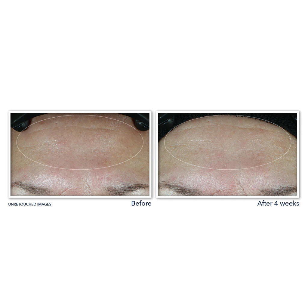 MULTI CORREXION® Hydrate + Plump Moisturizer With SPF 30
