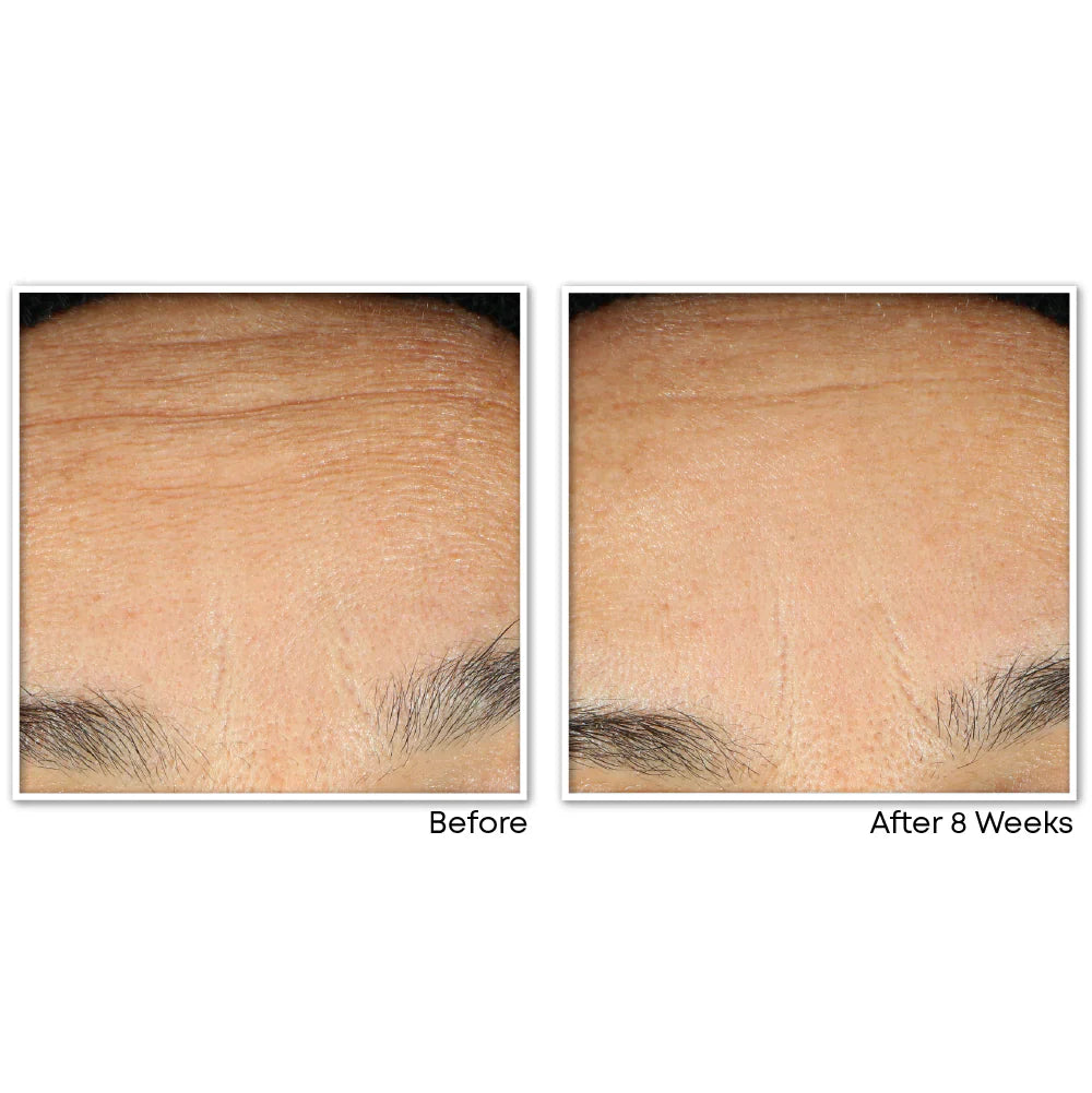 RETINOL CORREXION® Line Smoothing Night Serum Capsules