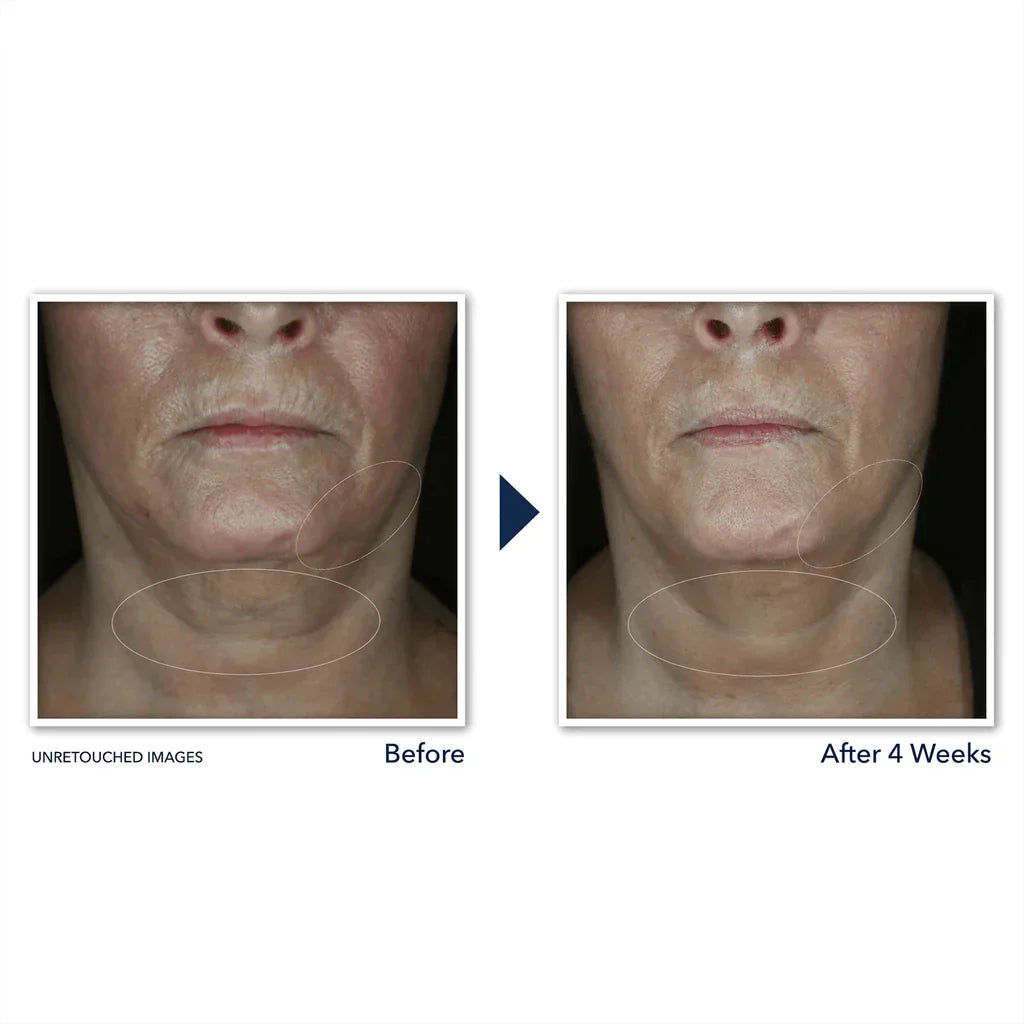 DERM CORREXION® Contour Cream