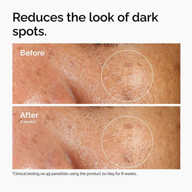 The Ordinary  Alpha Arbutin 2% + HA