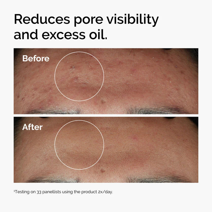 The Ordinary  Niacinamide 10% + Zinc 1%