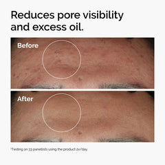The Ordinary  Niacinamide 10% + Zinc 1%