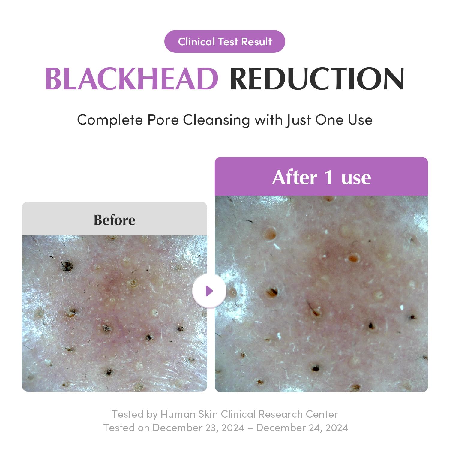 Eqqualberry Purple Rice Pore Purifying Pack Cleanser 130g