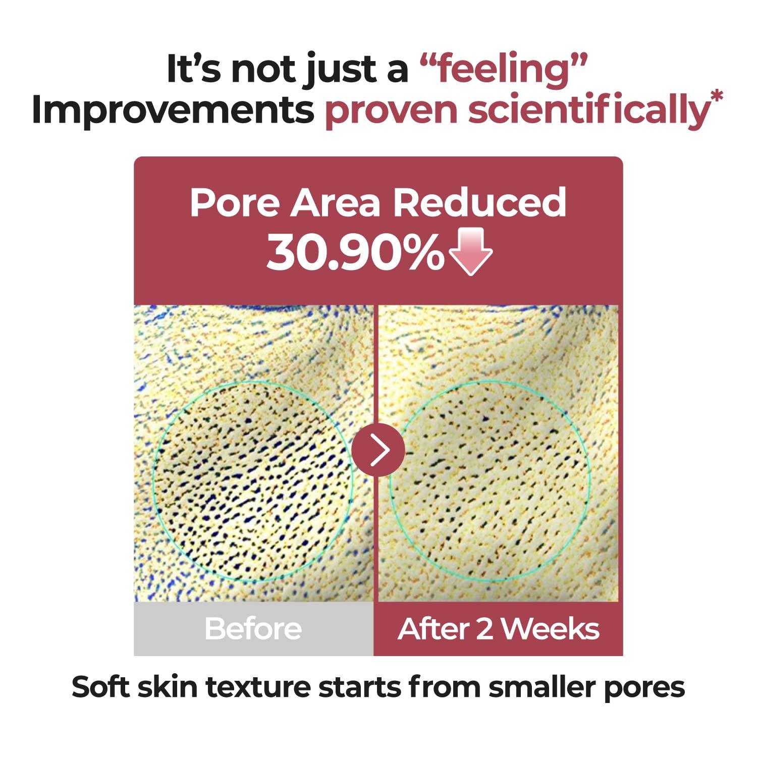 Numbuzin - No.3 Skin Softening Serum - 50ml